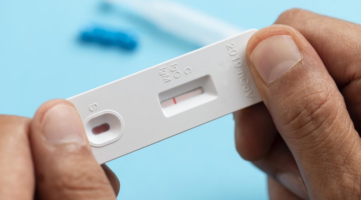 CDC Test