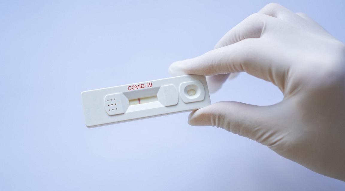 Covid-19 test